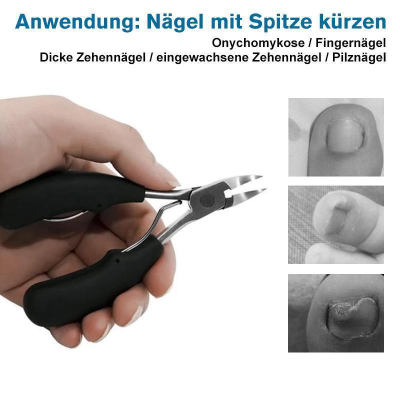 👍👍304 Edelstahl Nagelknipser-Set, Vorbeugung von Paronychie, Pilzinfektion