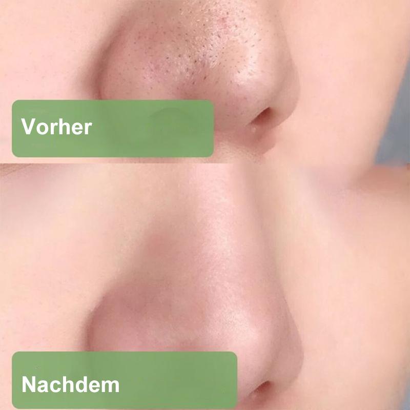 Heißer Verkauf - Porenlose Tiefenreinigungs-Grüntee-Maske